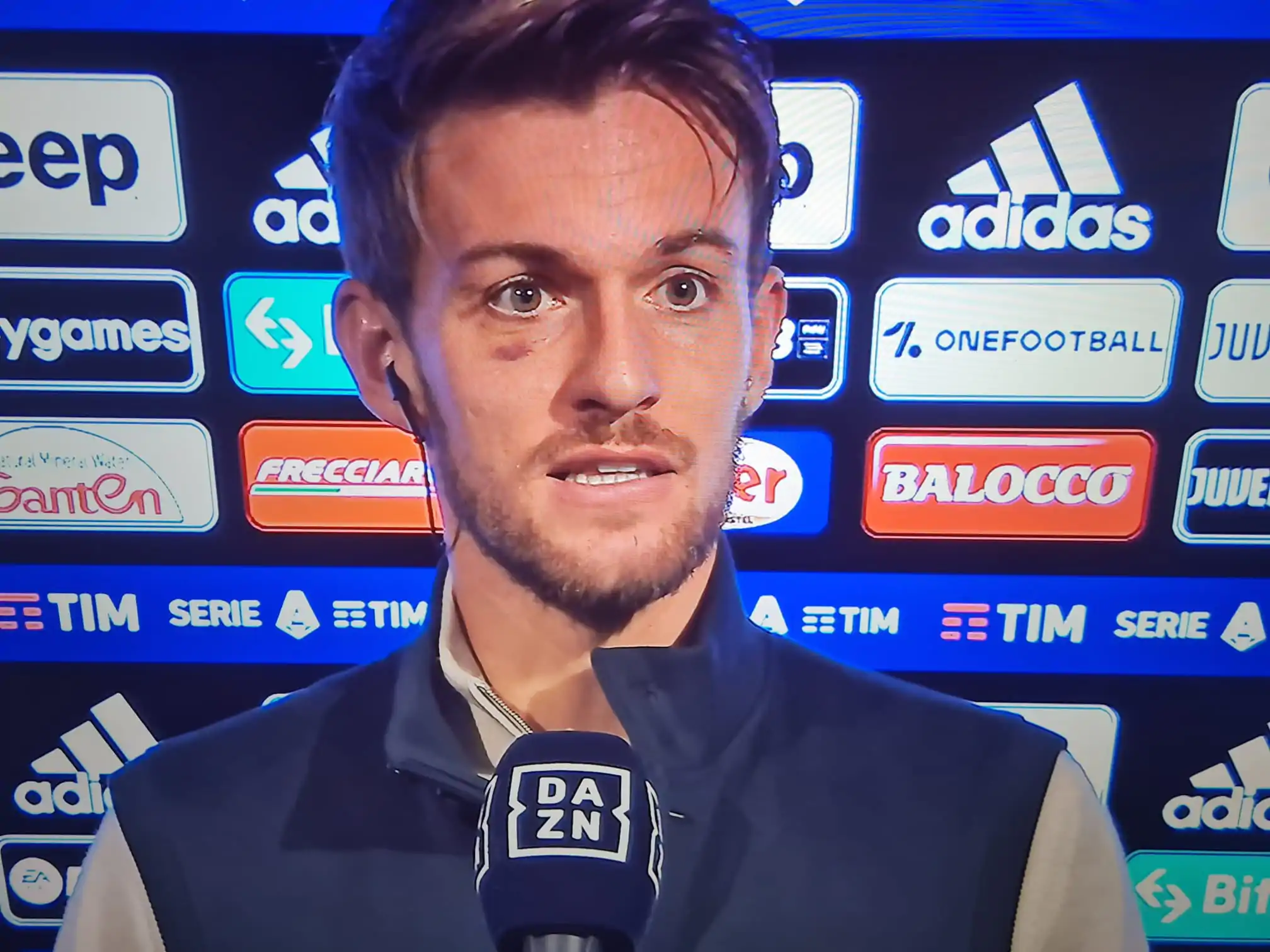 Rugani: “Non so spiegare i primi mesi della Juve. Vi dico qual è stato il nostro grande pregio”